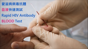 HIVBloodTest